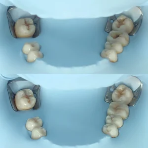 Dentística